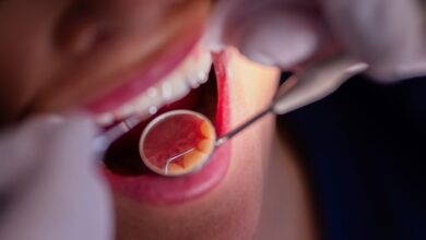 Стоматолог перечислил ухудшающие состояние зубов продукты
