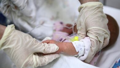 Российские хирурги провели уникальную операцию младенцу с патологией аорты