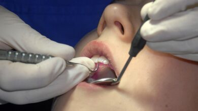 Стоматолог назвала пять портящих здоровье зубов привычек